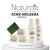 Popular Melasma & Acne Peeling Set by Naturae, USA